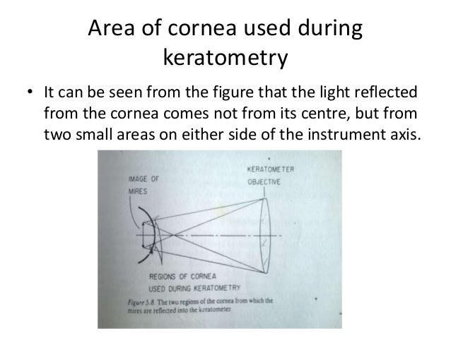 Diagram Of Keratometer Wiring Diagram Home